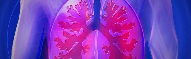 תופעות לוואי להשמנת יתר